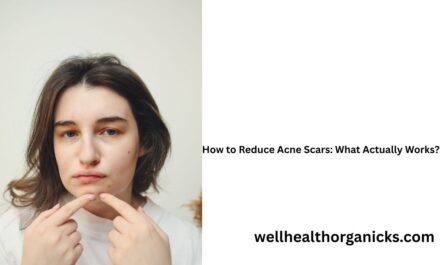 How to Reduce Acne Scars