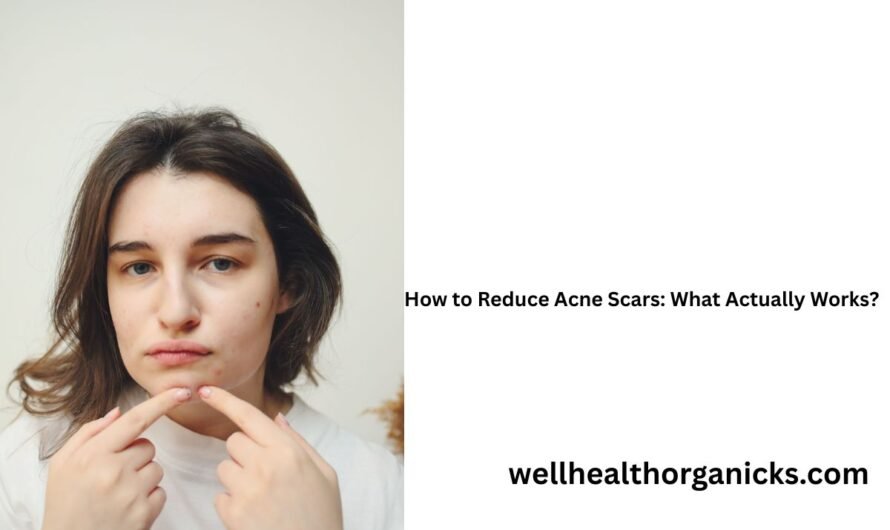 How to Reduce Acne Scars: What Actually Works?