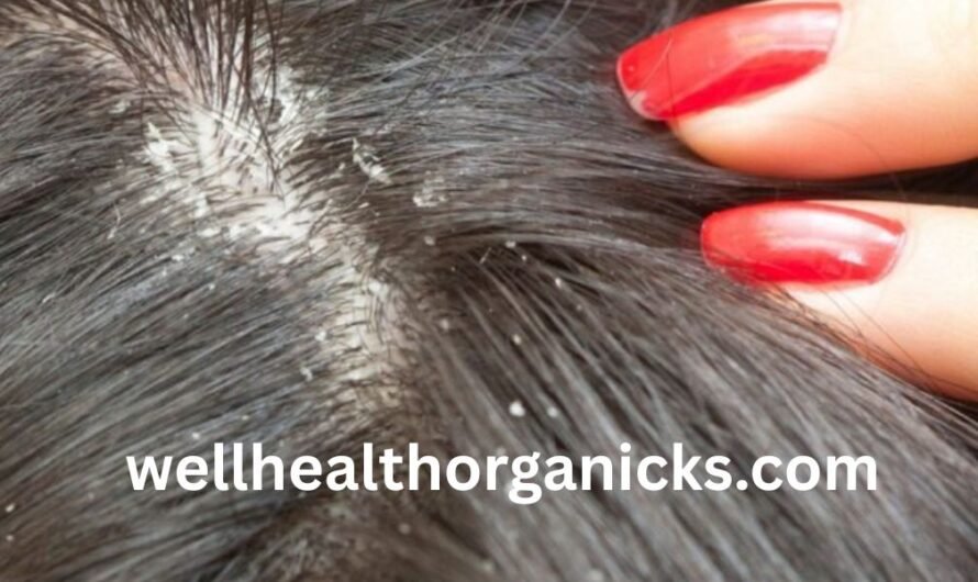 Itchy Scalp से राहत पाने के 5 असरदार घरेलू उपाय |
